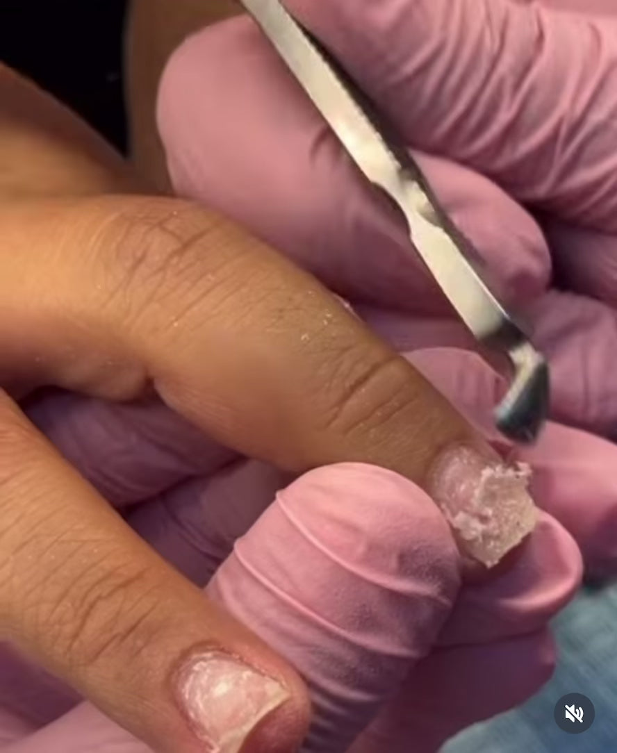 Be Gone! Gel Remover VB